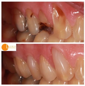 General restorative dentistry page