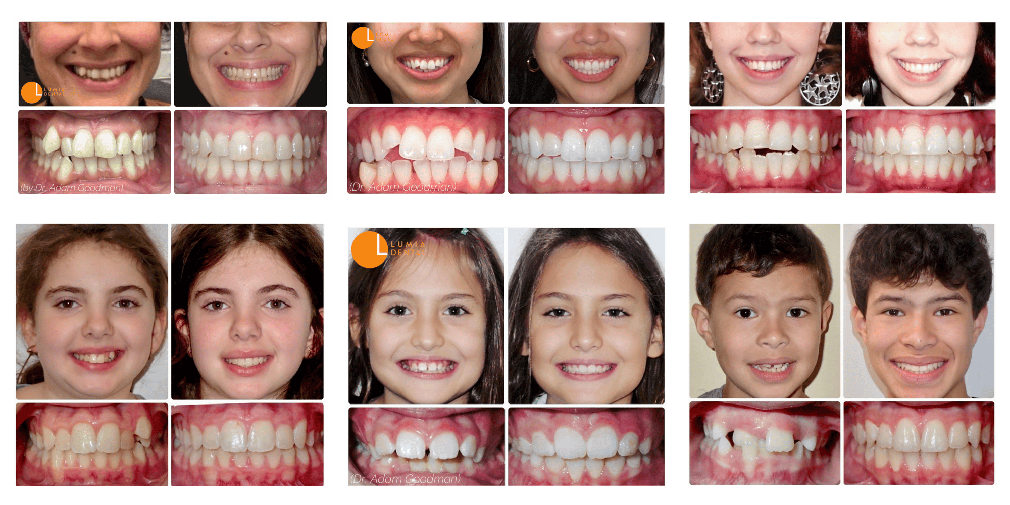 Thousands of Invisalign cases