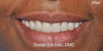 complex-dental-cases-after-nyc-e1517181461815-580x287