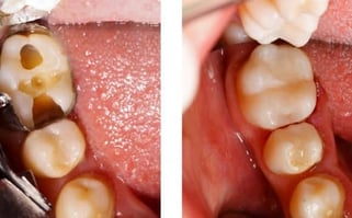 general-restorative-dentistry-nyc-580x360-1