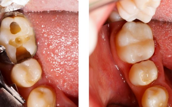 General restorative dentistry page