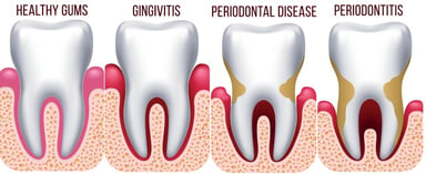 Periodontics NYC