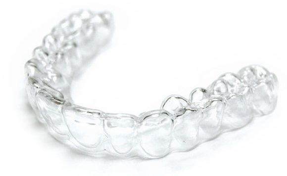 clearcorrect-aligner-e1516200039269-580x356-1 clearcorrect-aligner-e1516200039269-580x356-1