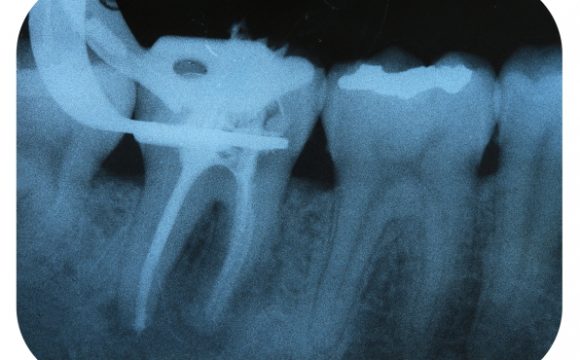 Endodontics