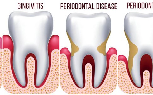 Periodontics