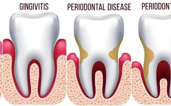 periodontics-nyc-1-580x299-11