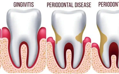 periodontics-nyc-1-580x299-12
